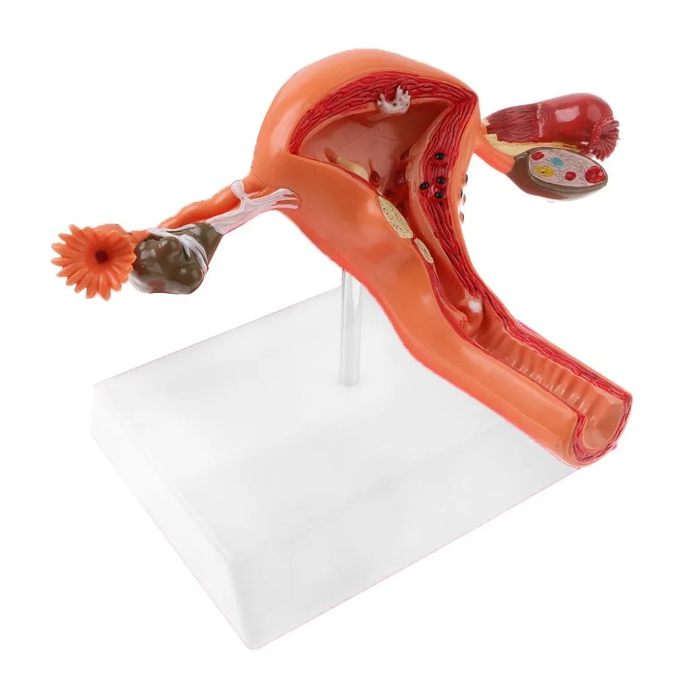 Human Female Uterus  Pathology Model Body Woman Pathological Uterus Ovary Anatomical Model Anatomy Cross Section