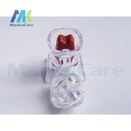 3 pcs Oral Model 4 Times Dental Implant Disease Teeth Model with Restoration Bridge Tooth Model Dentist for Medical Teaching