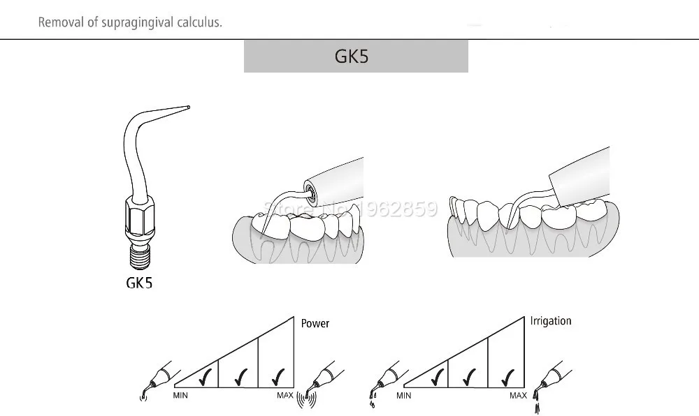 5pcs/lot GK5 Scaler Tips Tools for KAVO Dentist Dentistry Instrument Dental Equipment Ultrasonic Scaling Tip Compatible KAVO GK5