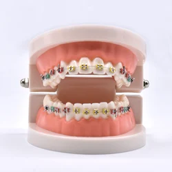 Dental ortodontyczne leczenie Model z Ortho metalowy uchwyt ceramiczny łuk drut tubka dentystyczna podwiązki