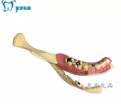 tooth model right mandible decomposition model Oral model  free shopping