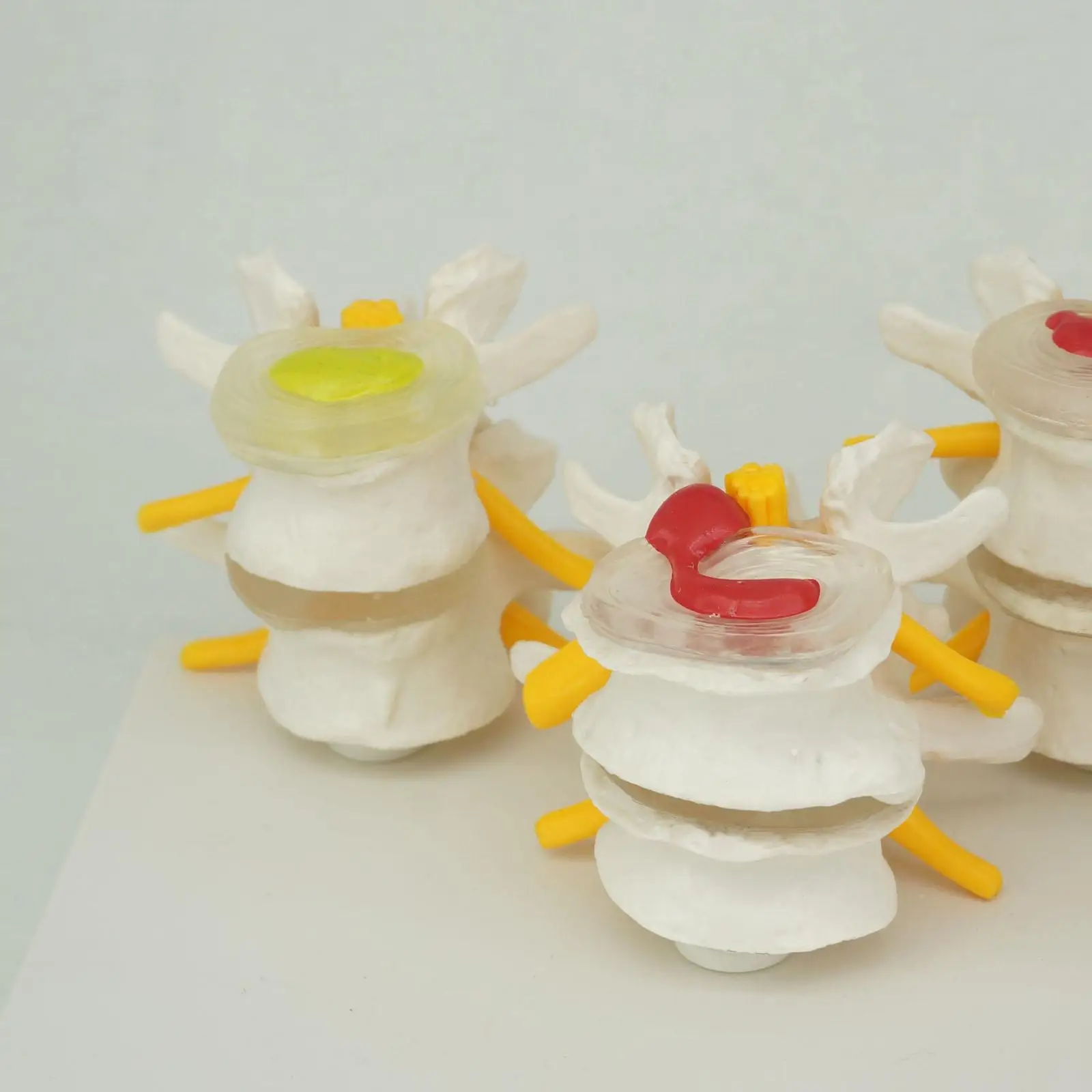 Vértebras Lombares Humanas Anatômicas Do PVC, Doença Degenerativa Do Disco, Modelo Médico