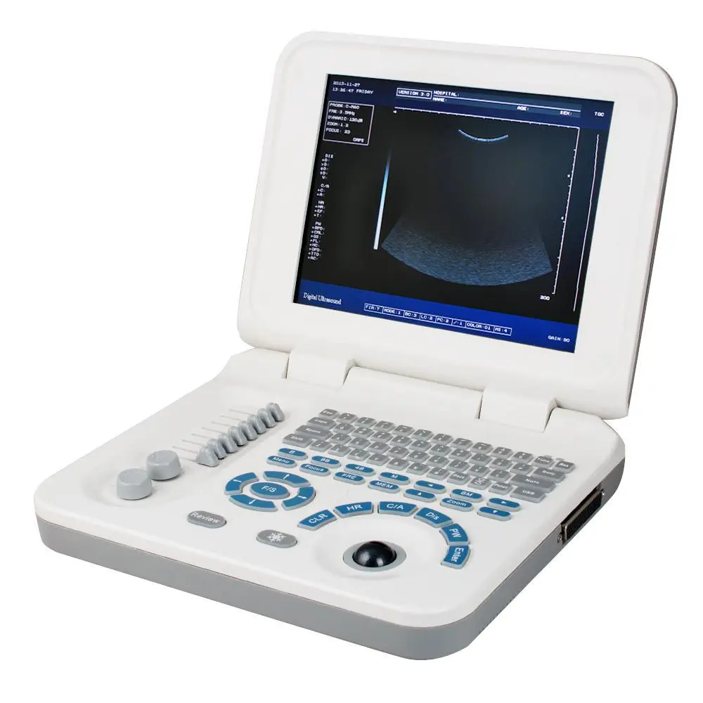 New Good Quality 10 Inch LED Screen Notebook Portable Ultrasound Scanner Machine