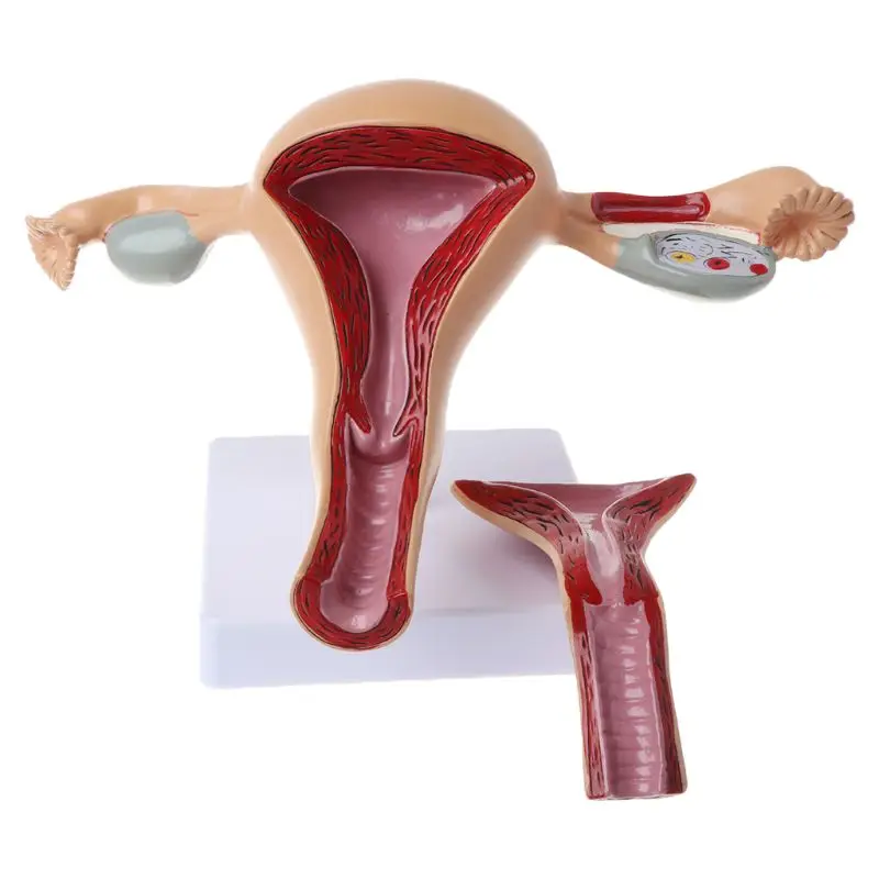 Medical props model Human Pathological Uterus Ovary Model Anatomical Anatomy Disease Pathology Medical Lesion For Teaching