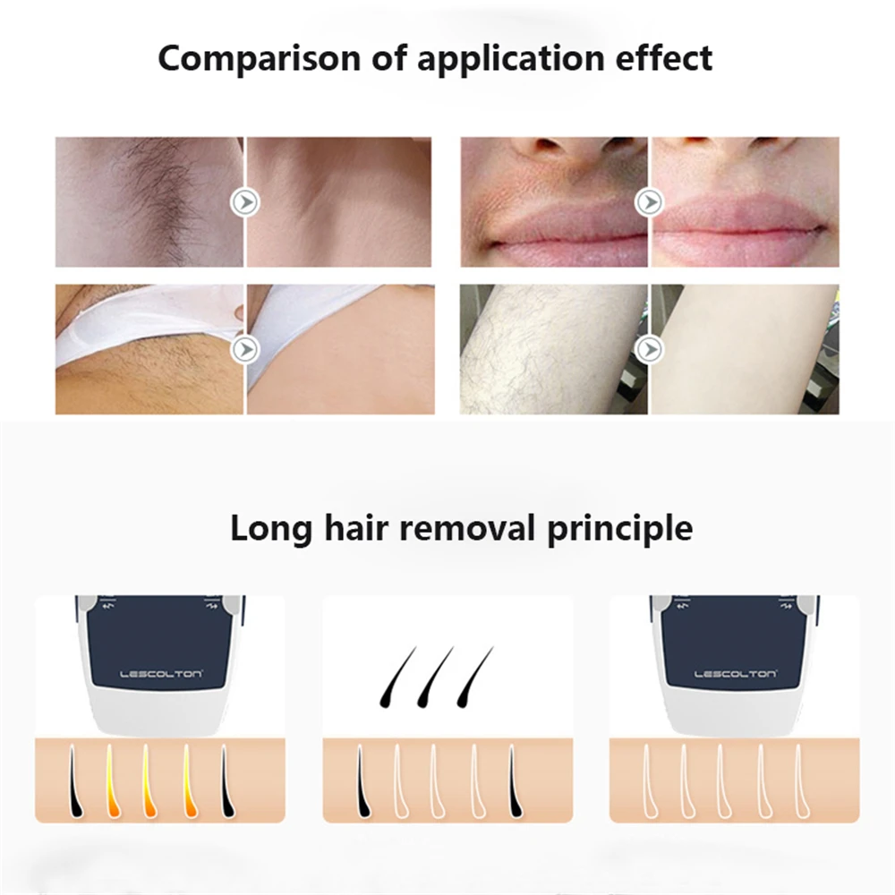 Lescolton IPL เครื่องกำจัดขนกำจัดขนเลเซอร์ Depilation เครื่องบิกินี่ผู้หญิง Depilatory Shaver T006