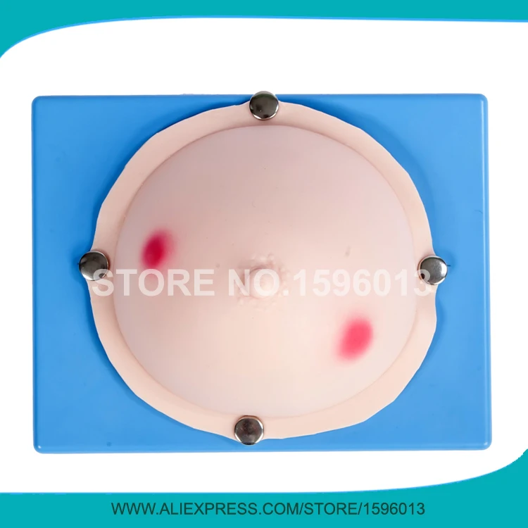 

Vivid Mammary Abscess Examination Model,Breast Examination Model,Breast Abscess Simulator