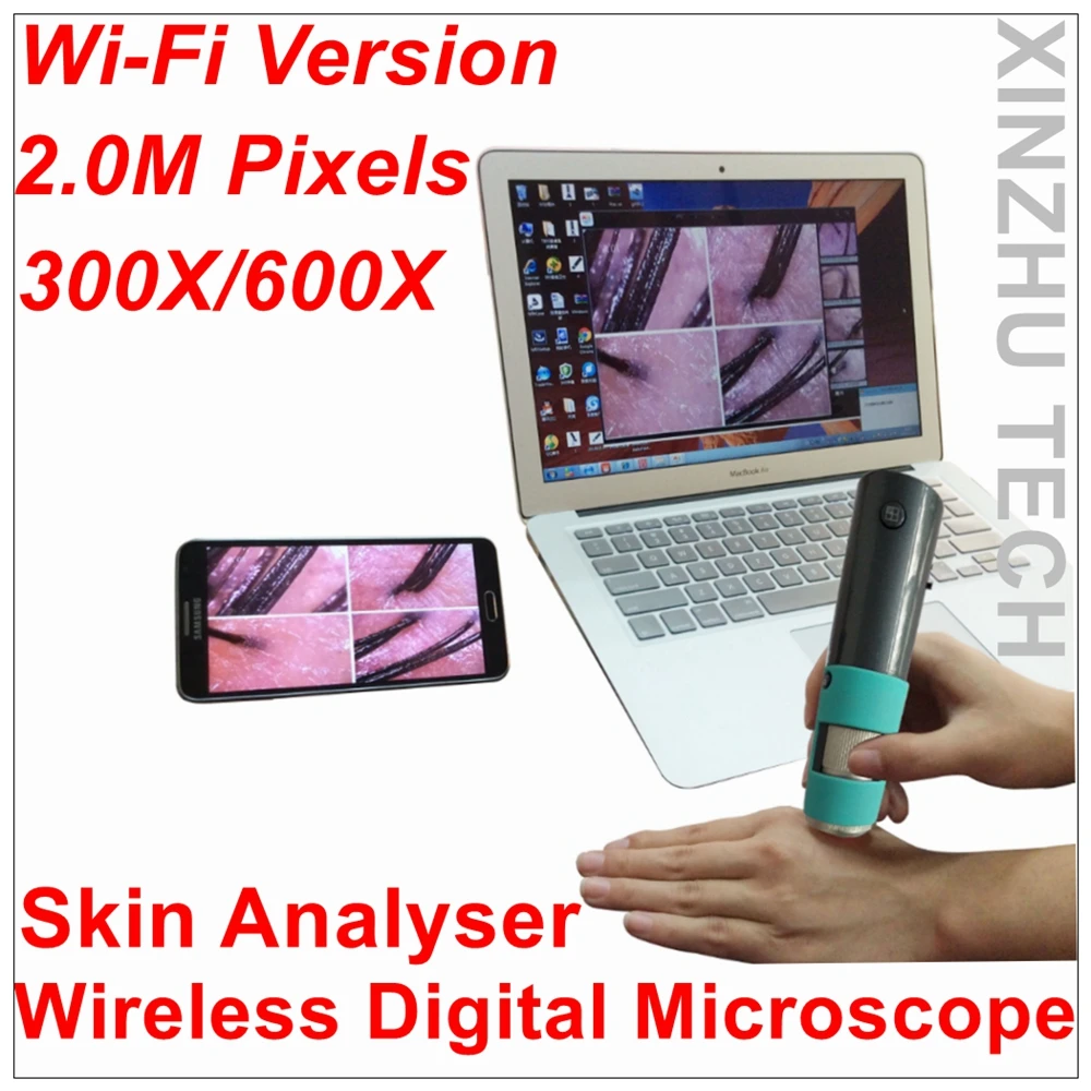 مجهر رقمي مع wi-fi ، M30F ، مجهر بكاميرا M ، من من من من من من نوع P HD ، 600x Zoom ، ISO ، Windows ، andr ، إلكتروني ، محلل الجلد
