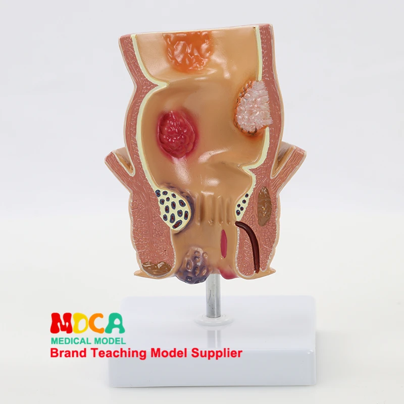 Rectal Model Colon Demonstration Model Teaching Medical Anorectal Medicine Teacher Supplies for Classroom