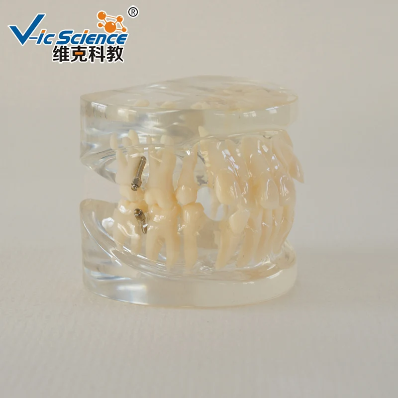 

24PCS Dental Type Orthodontic Teeth Model