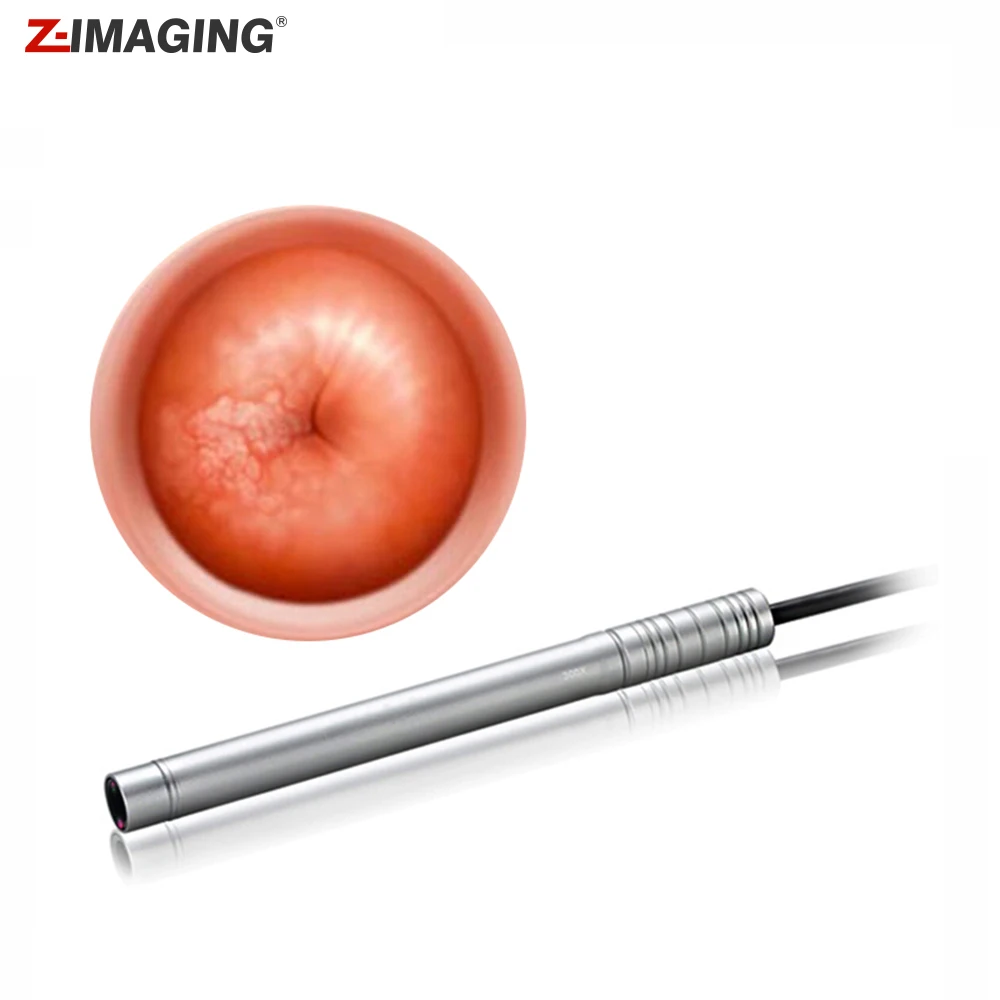 Women - specific microscope endoscope dedicated microscope endoscope detection of internal health Electronic Colposcope