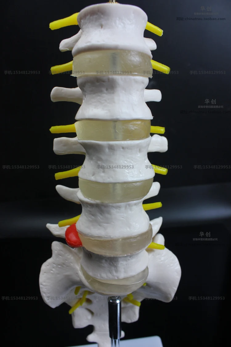 Medical use teaching Lumbar vertebra natural 1:1 adult caudal vertabra model orthopedics model umbar disc herniation model 30cm