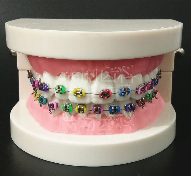 1PC Dental Orthodontic Treatment Model With Ortho Metal Bracket Arch Wire Buccal Tube Ligature Ties