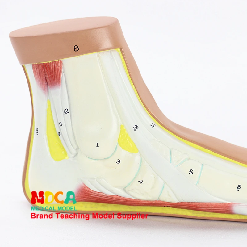 Flat Foot, Flat Foot Arch Collapse Model Joint Anatomy Model Medical Teaching Supplies