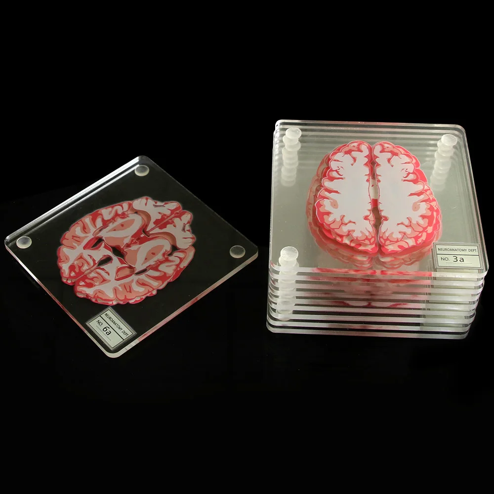 Brain Specimen Coasters Set 3D Organ Brain Artwork Brain Slices Square Acrylic Glass Drinks Table Coaster Drunk Scientists Gift