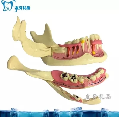 

tooth model right mandible decomposition model Oral model free shopping