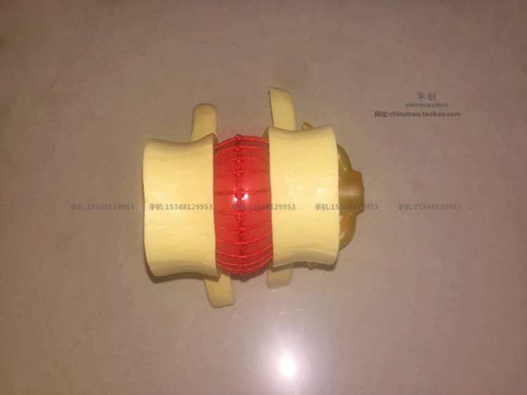 medical Two lumbar vertebra model Normal state CMAM VERTEBRA12  Life-size Lumbar Vertebrae Models in 3 Stages of Degeneration