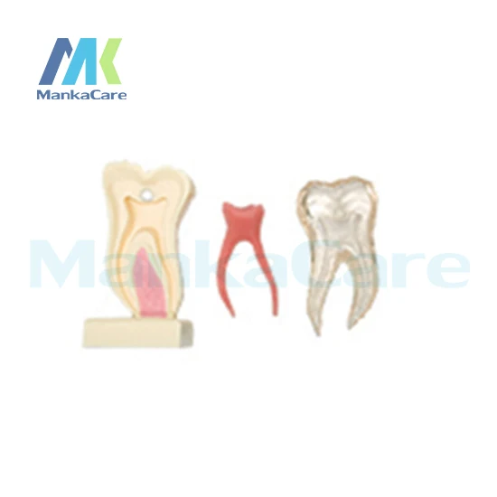 

6 Times Anatomic Profile Model of Mandibular Molar/Made from high quality resin,silicone rubber and crystal