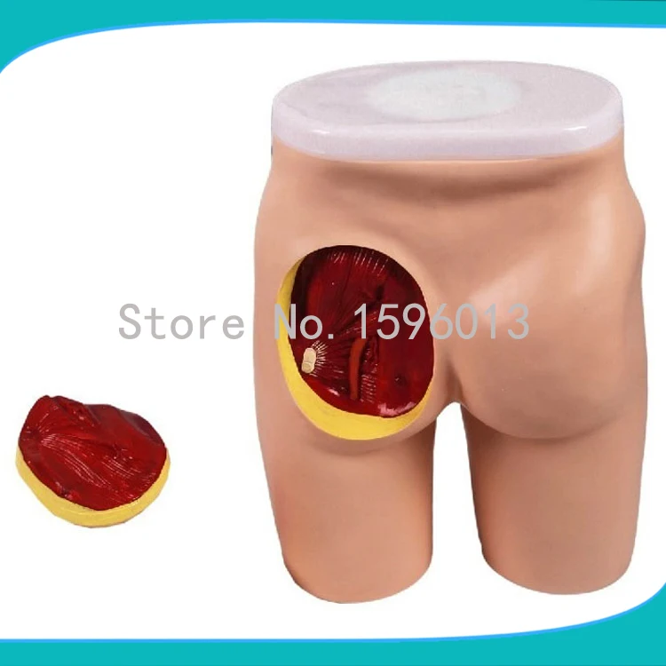 

Buttocks Intramuscular Injection And Anatomic Structure Model,Buttocks anatomical model