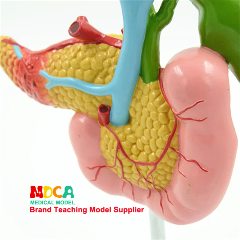 Diseased Pancreas Spleen Hepatobiliary Duodenum Model Human Pathological Anatomy Teaching Model