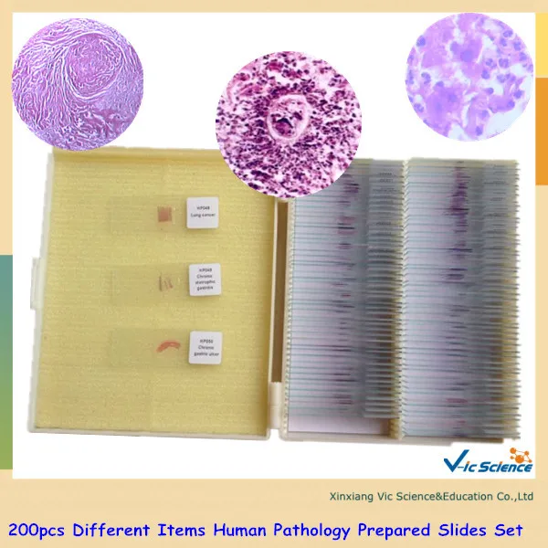 200pcs Different Items Human Pathology Prepared Slides Set