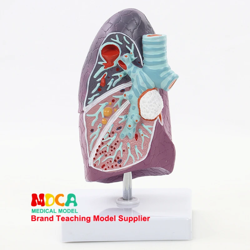 Pulmonary Structural Model Respiratory Department of Pulmonary Anatomy  Medical Classroom Supplies Teaching