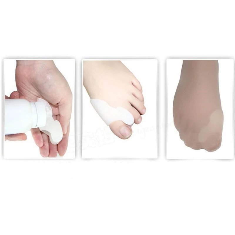 Corrector Hallux Valgus, triturador de escarabajos, electrodoméstico exterior, tecnología profesional, productos para el cuidado de la salud