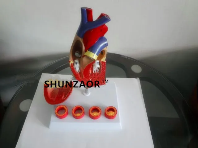 

Atherosclerosis Plastic Human Heart Model Medical Teaching toools