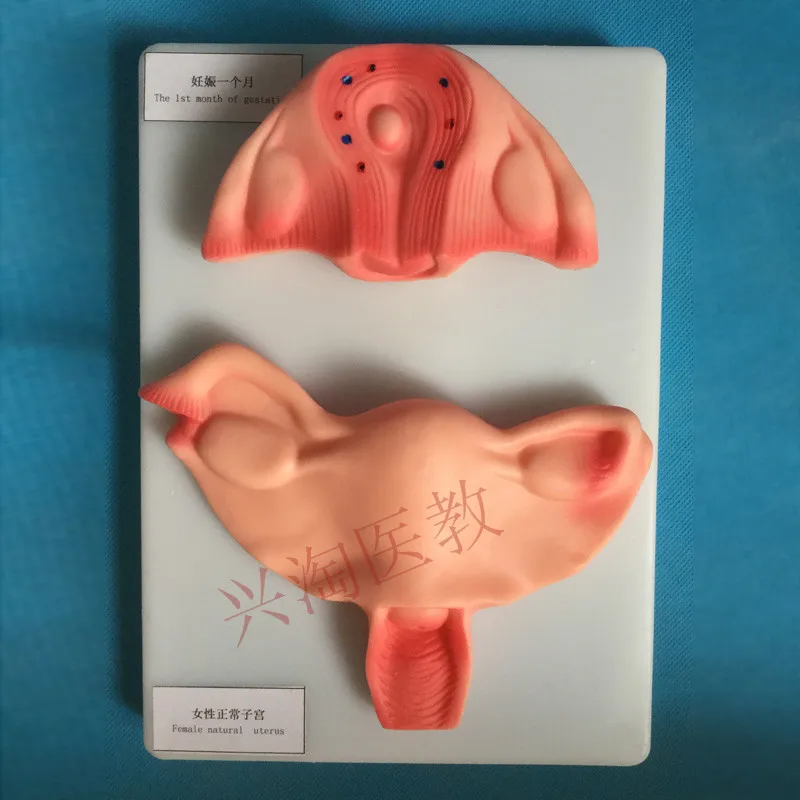 10 pcs fetus pregnancy Fetal development process Fetus medical educational demonstration model