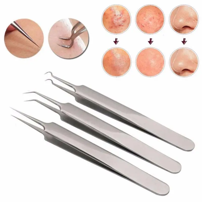 Handige Rvs Straight Bend Gebogen Mee-eter Acne Clip Pincet Puistje Comedone Remover Kit Gezicht Cleaner