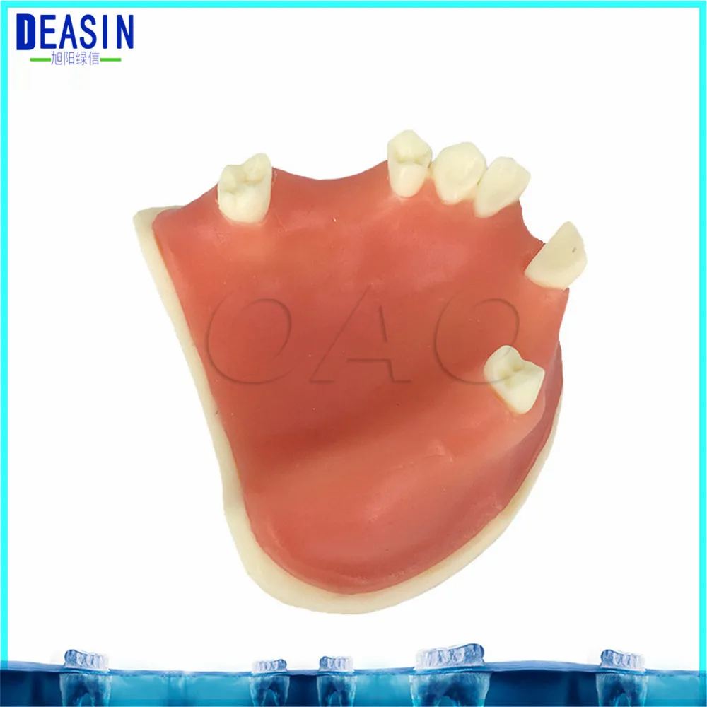 High Quality Implant practice model for teaching dental tooth teeth dentist anatomical anatomy model odontologia