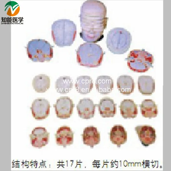 Human Head and Neck  Transection  Anatomical  Model BIX-A3001