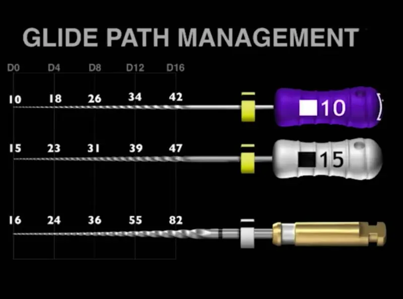 Tandheelkundige Glide Bestanden Dental Rotary Proglider Files Endodontische Gebruik Voor Wortelkanaalbehandeling Cleaning