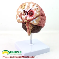 ENOVO – humain médical. Modèle de maladie du cerveau, modèle de microchirurgie, apoplexie du cerveau, hémioration