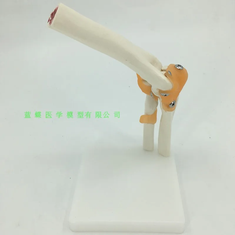 

Elbow joint model skeleton model free shopping