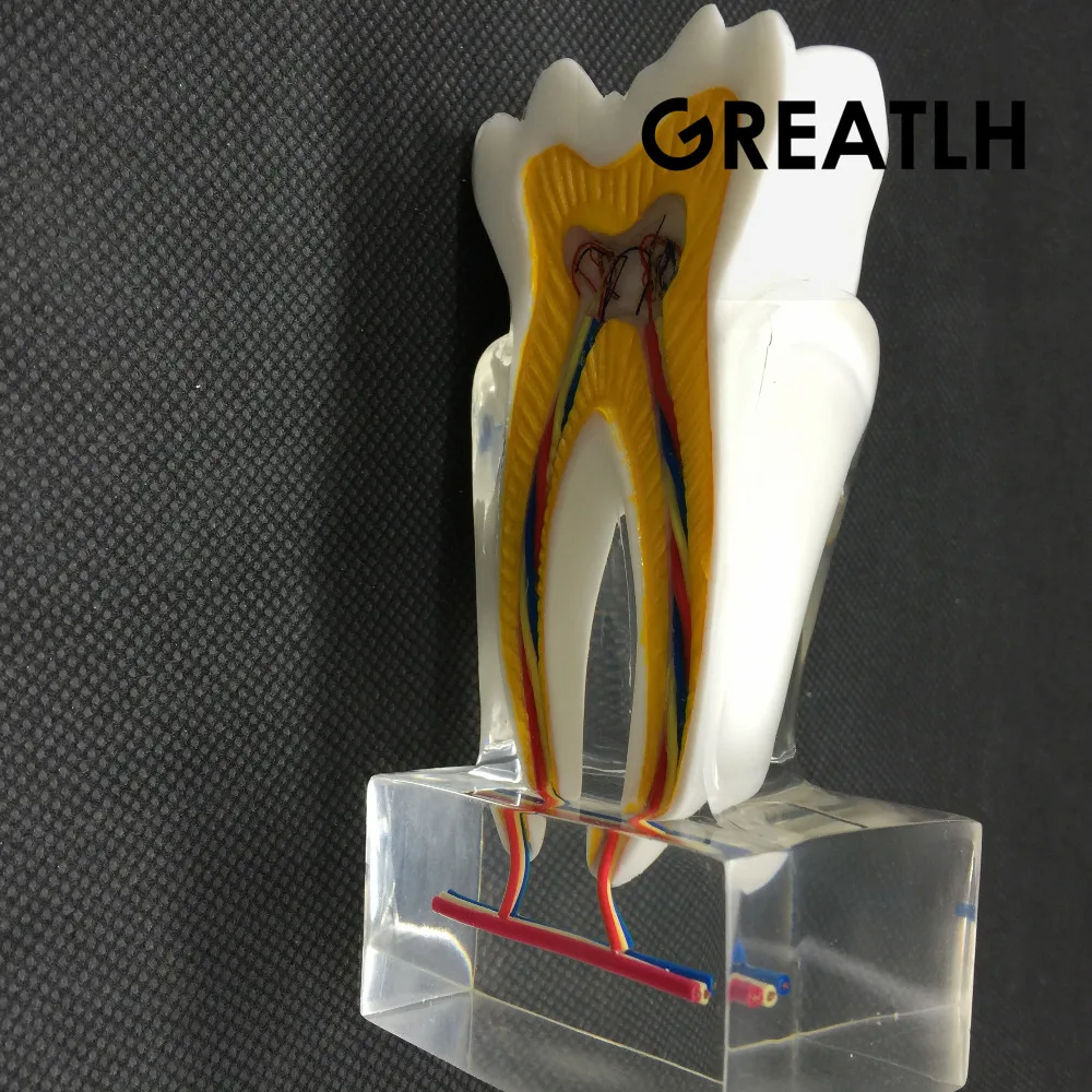 Dental anatomiczny Model molowy 2017 molowa struktura wewnętrzna z nerwami i naczyniami