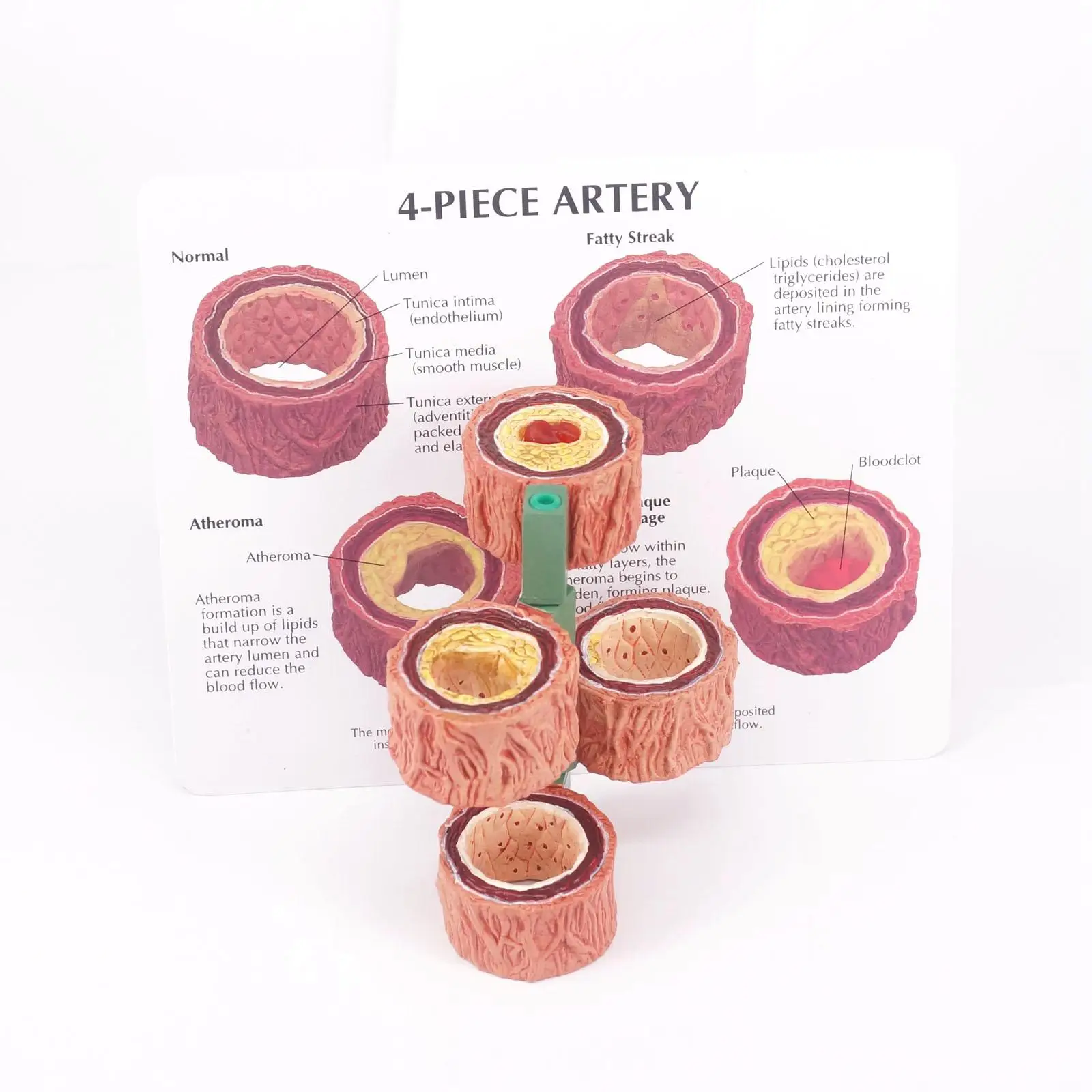 PVC 4 단계 교차 섹션 인체 동맥의 해부학 혈관 폐색 모델, 의료 학습 키트