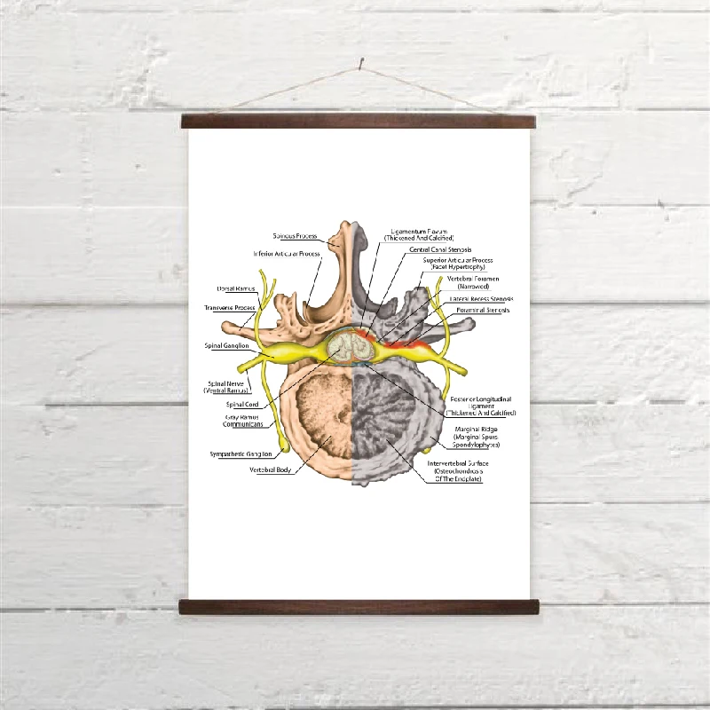 Human Nervous System Prints Osteoarthritis Poster Medicine Educational Chart Orthopedics Office Wall Art Decor Canvas Painting