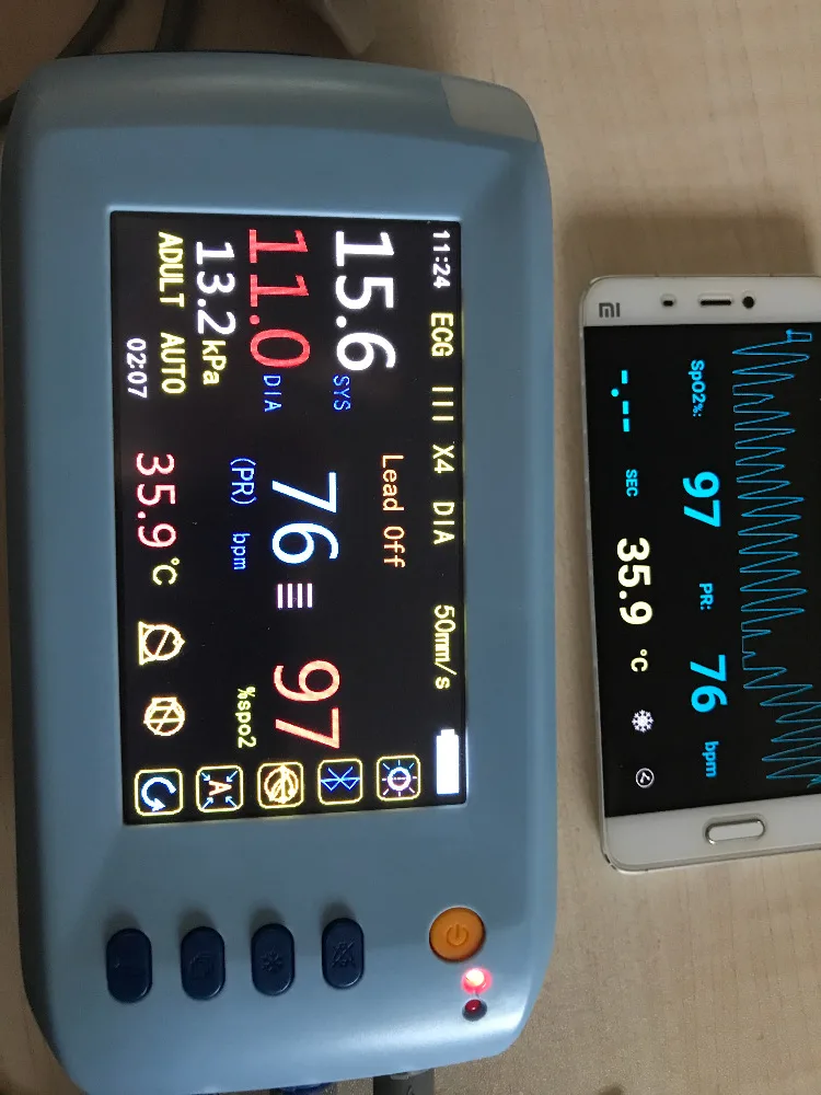 Imagem -03 - Toque o Monitor Paciente de Screnn com Ecg Nibp Spo2 Taxa de Pulso Monitor Médico dos Cuidados Médicos do Monitor Paciente de Bluetooth da Temperatura