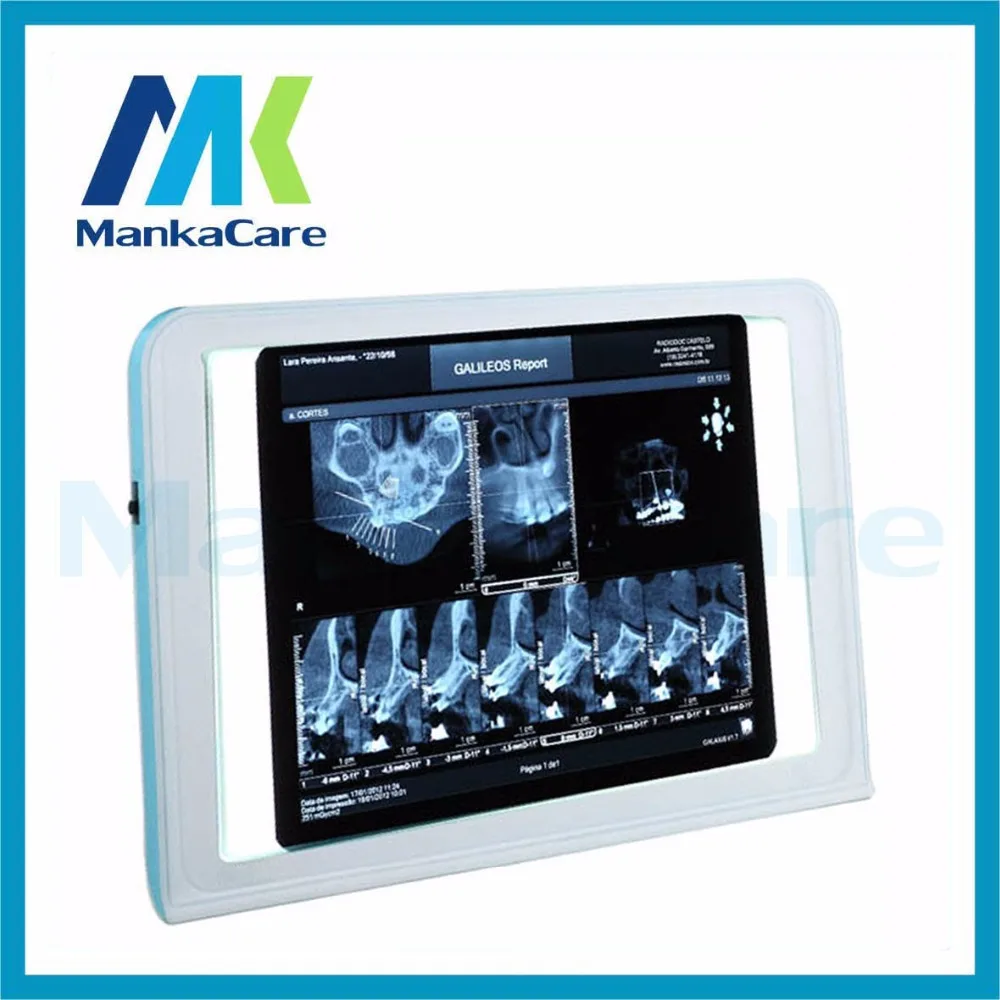 

Dental Clinic X-Ray Film Illuminator Light Box Xray Viewer Light Panel Screen For Dentistry Lab Supplies medical negatoscope