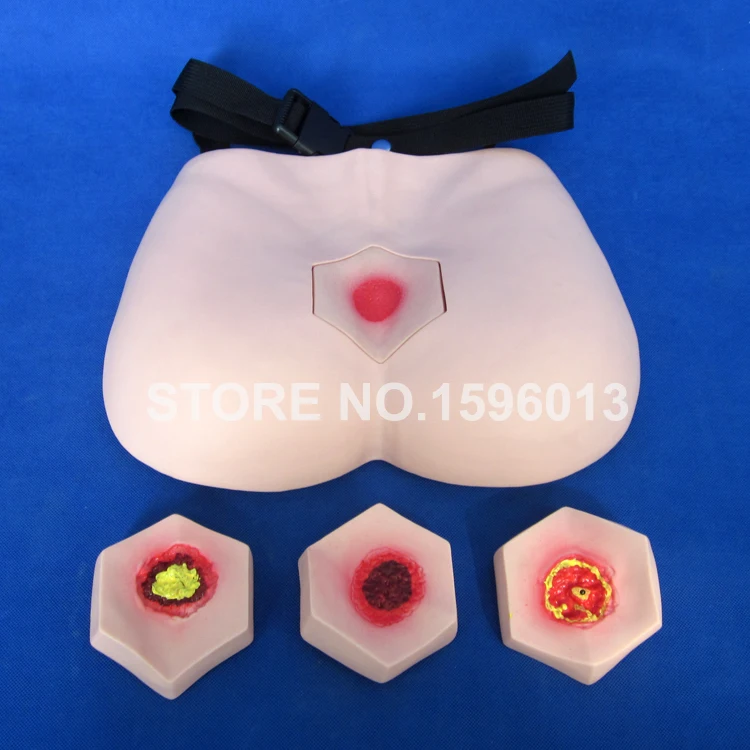 Decubitus Ulcer Stages Care Model Pressure Ulcer Sores Training Simulator