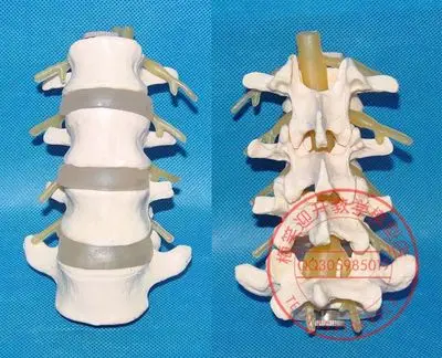 

Человеческая поясница позвоночника модель человеческого позвоночника медицинская обучающая модель бесплатная доставка