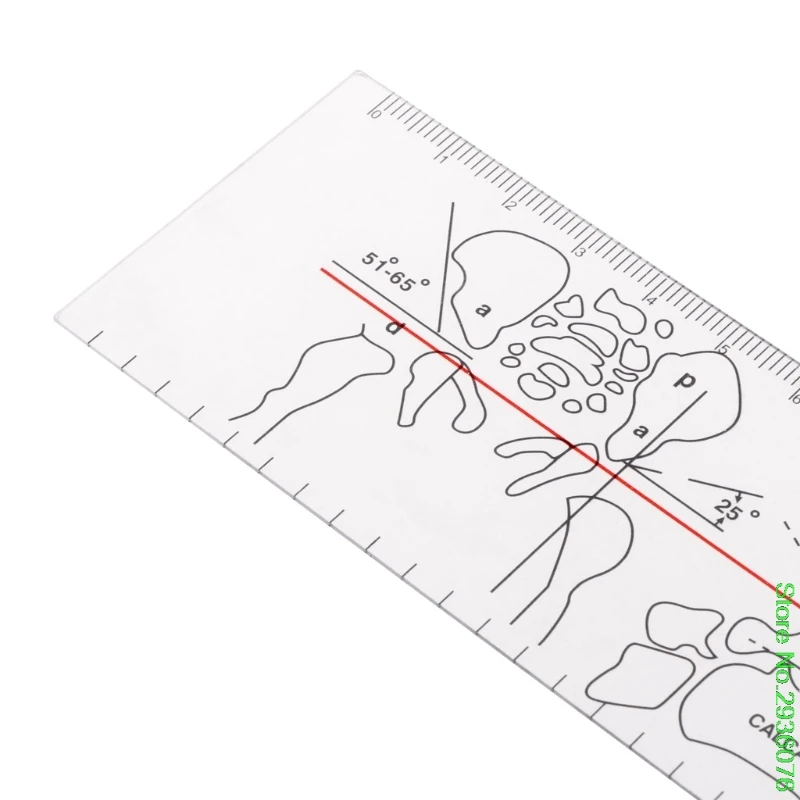 New Arrive Goniometer Angle Medical Ruler Rule Joint Orthopedics Tool Instruments Plastic Support