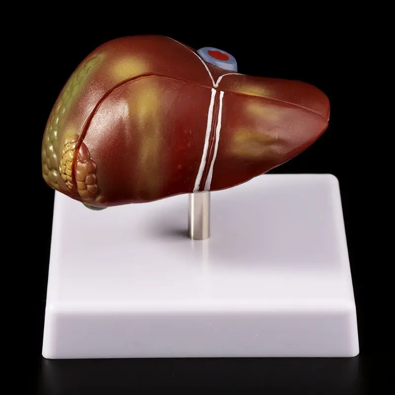 Medical props model Human Liver Pathological Anatomical Model Anatomy School Medical Teaching Display Tool Lab Equipment