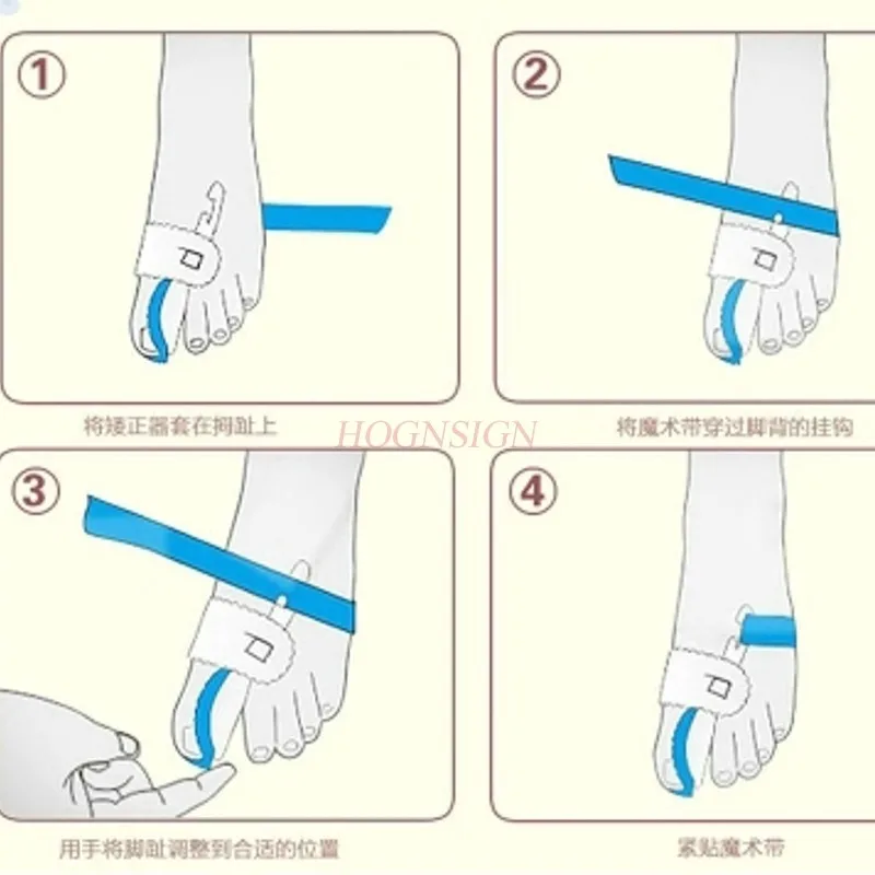 Noite toe hallux valgus pé grande osso orthose polegar valgus correção do dedo do pé cabeça correção, formação de homem e mulher