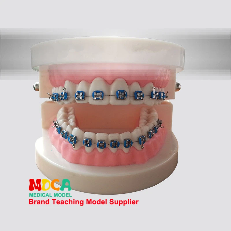 Dental Model Orthodontics Tooth Teeth Model Dental Tooth Research Model Teacher Supplies for Classroom