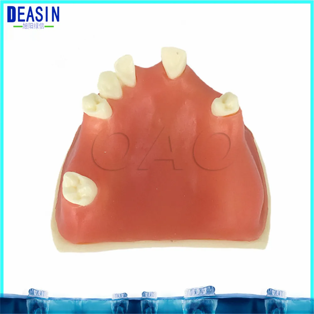 

High Quality Implant practice model for teaching dental tooth teeth dentist anatomical anatomy model odontologia