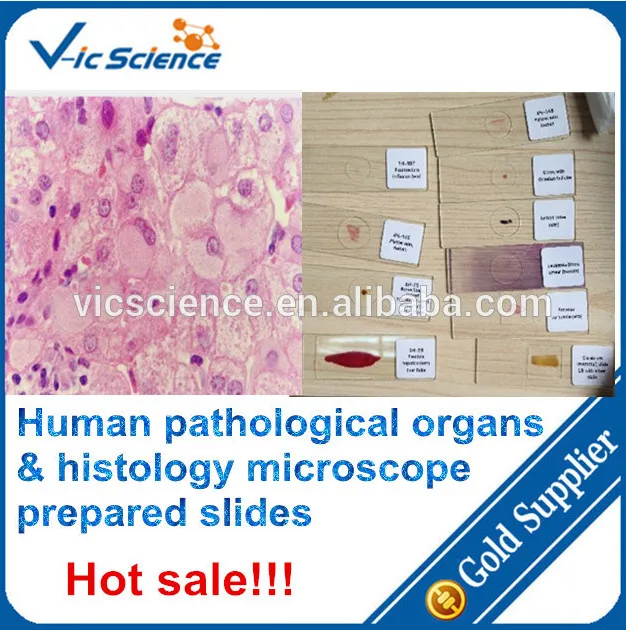 Human pathological organs and histology prepared slides,pathological organs slides,human organs slides