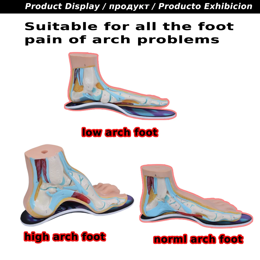 EXPfoot Top Selling High quality EVA Flatfoot Orthotic Insole  Arch Support 2.5cm Orthopedic Silicone Insoles Foot Care   045