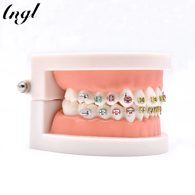 Dental Orthodontic Treatment Model With Ortho Metal Ceramic Bracket Arch Wire Buccal Tube Ligature Ties Dental Tools Dentist Lab