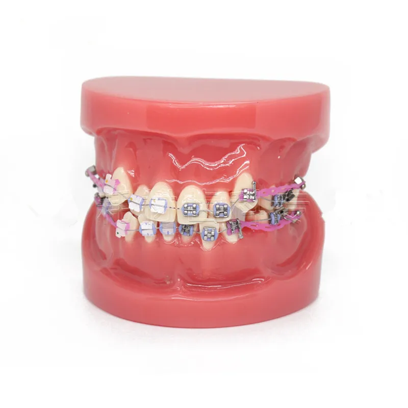 

New Dental Orthodontic Treatment Malocclusion Model With Ceramic Brackets Chain Wire For Medical Science Teaching 2018 New